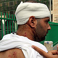 Nir Nachshon, brutally beaten Photo: Gil Yohanan