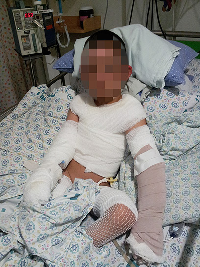 אחד הפצועים במתקפה, ילד בן 3. האב פצוע קשה, נמצא בתרדמת (צילום: חסן שעלאן)