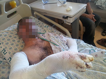 אחד מבני המשפחה הפלסטינית נפצעו באורח קשה (צילום: חסן שעלאן)