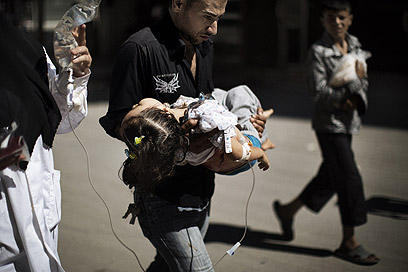 ילדה שנפגעה בחלב (ארכיון) (צילום: AFP)