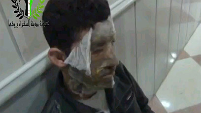 על פי המורדים, אלו אזרחים שנפגעו בהתקפת נשק כימי מצד המשטר